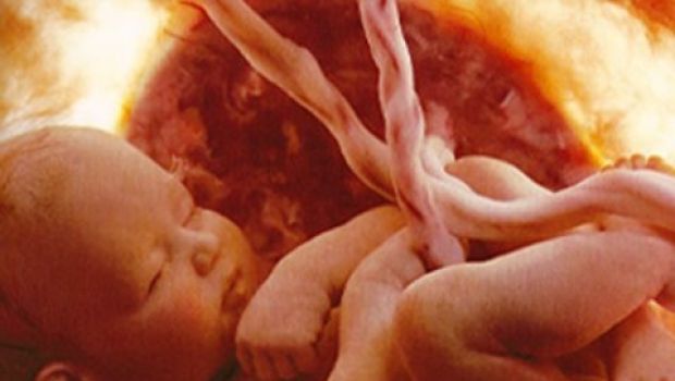 Trasfusioni e trapianto in utero, prima volta al mondo